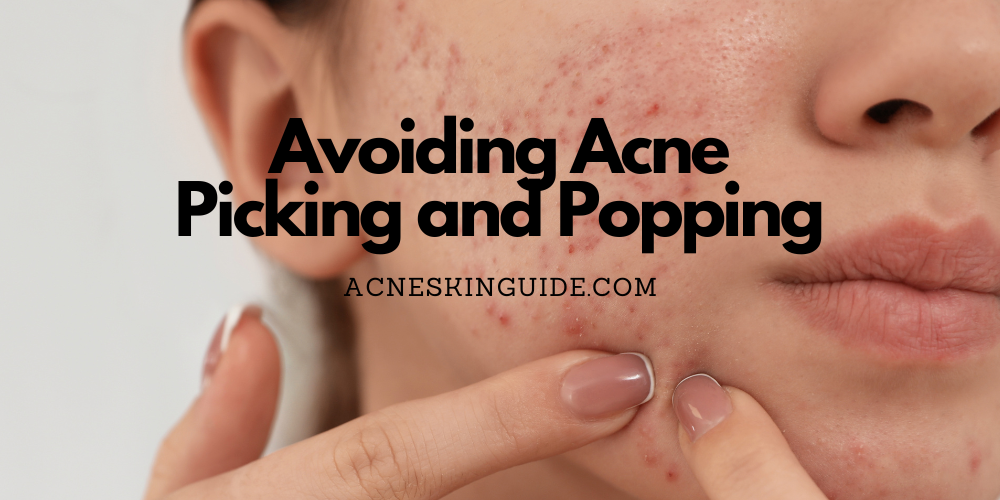 Avoiding Acne Picking and Popping