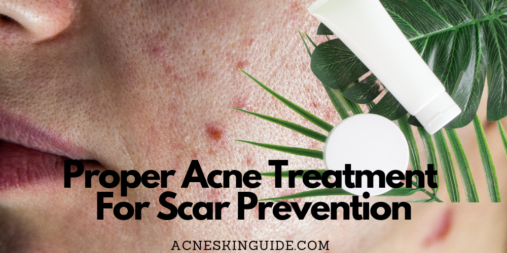 The Importance of Proper Acne Treatment for Scar Prevention