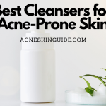 Best Cleanser Types for Acne-Prone Skin