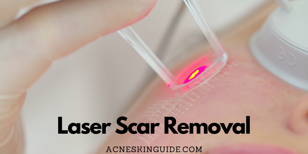Laser Scar Removal